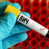 Гетеросексуальный половой путь заражения ВИЧ в России превысил инъекционный