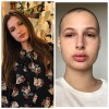 Моя дочь заболела лимфомой Ходжкин